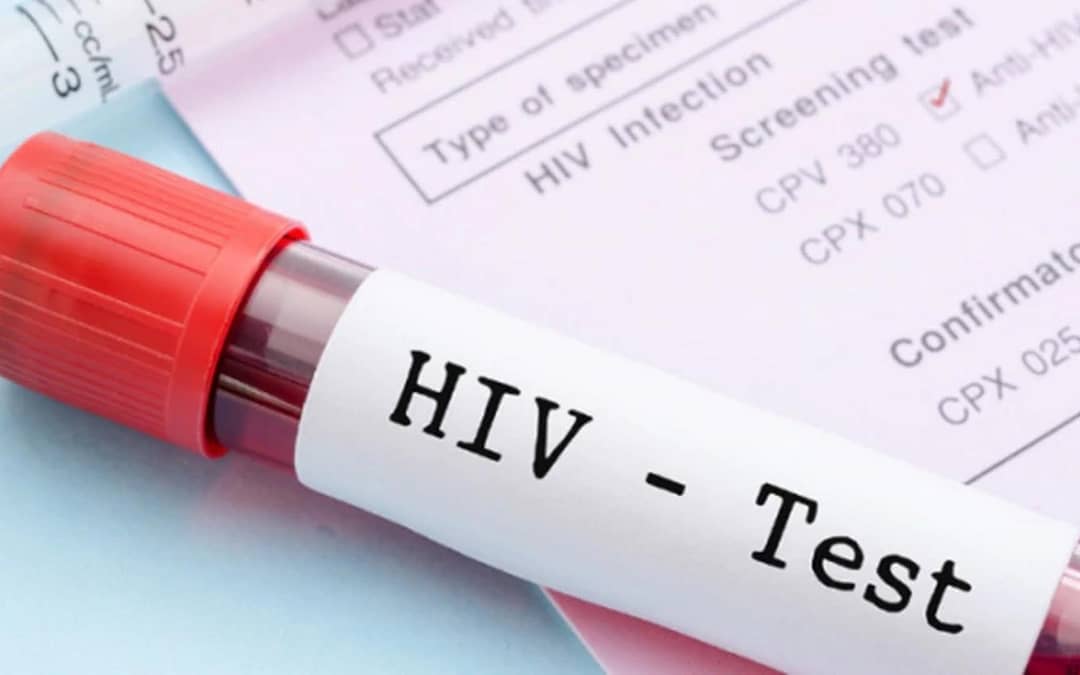 En Salta 50 personas son diagnosticadas de VIH  por mes